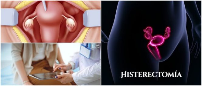 ¿La EPS puede negarle a una mujer una histerectomía por razones de edad fértil?